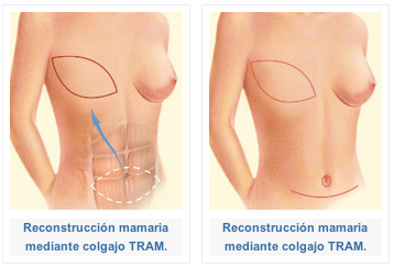imagen ilustrativa
