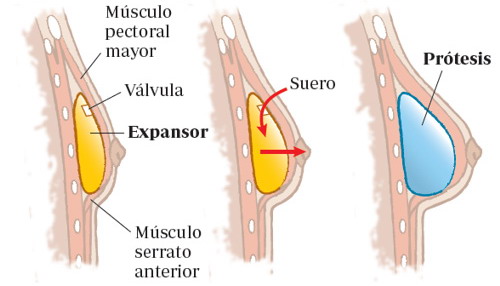 imagen ilustrativa