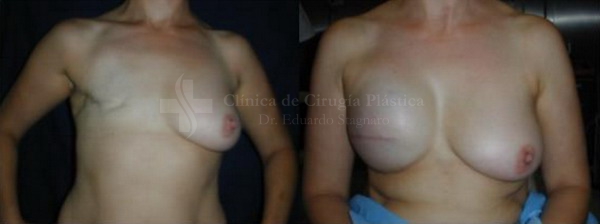 imagen ilustrativa